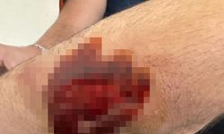 Diyarbakır’da sağlıkçılara bıçakla saldıran üç zanlı tutuklandı!
